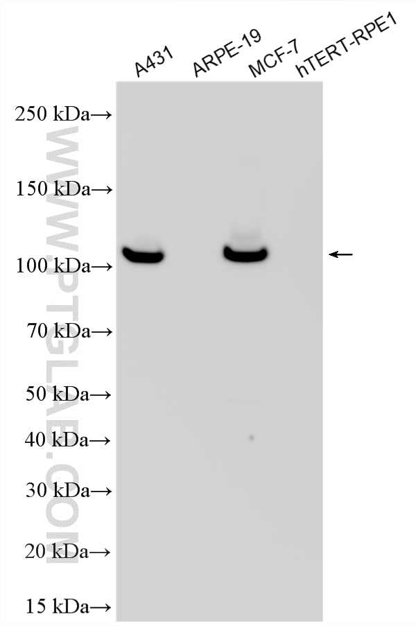 Western Blot (WB) analysis of various lysates using E-cadherin Recombinant monoclonal antibody (80541-5-RR)