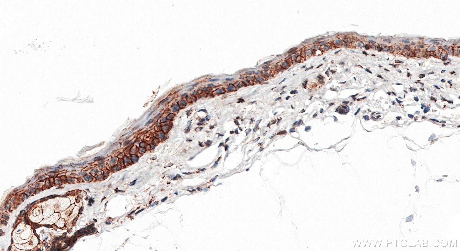 IHC staining of mouse skin using 80541-7-RR Immunohistochemistry (IHC) staining of mouse skin tissue using E-cadherin Recombinant monoclonal antibody (80541-7-RR)