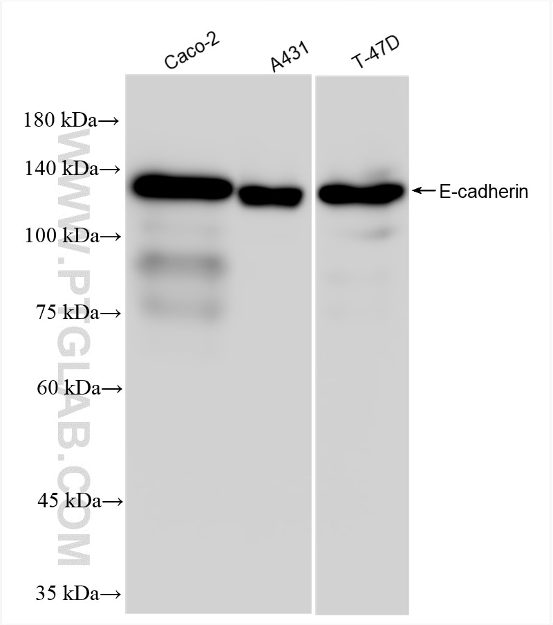 E-cadherin