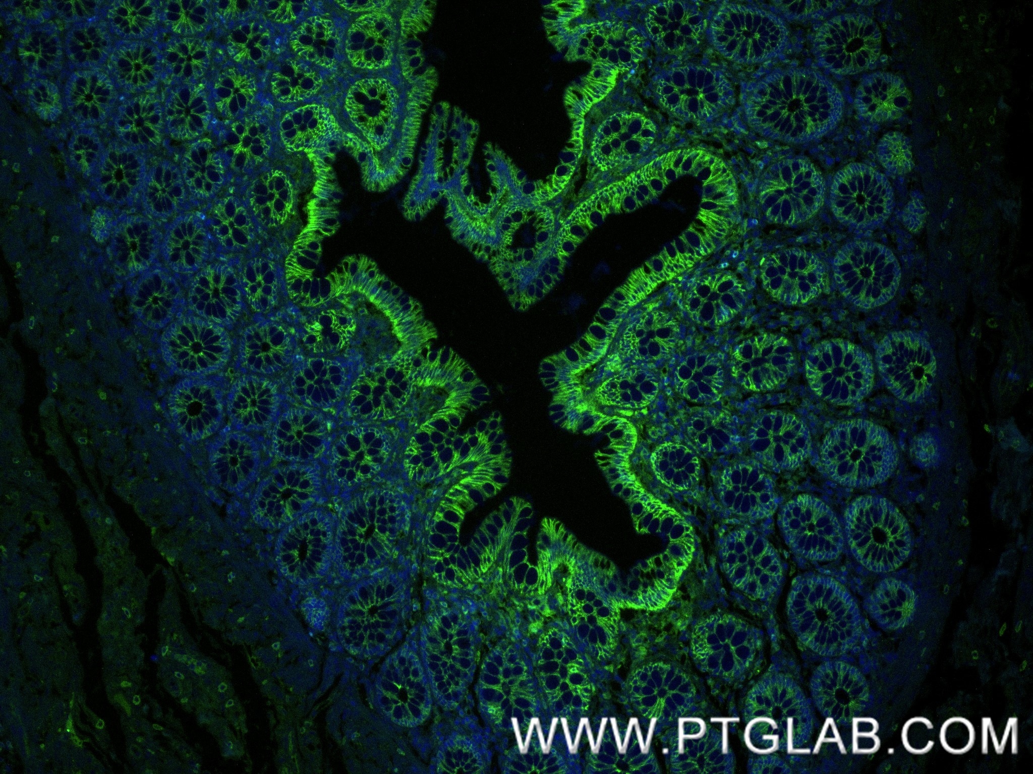 Immunofluorescence (IF) / fluorescent staining of human colon  tissue using E-cadherin Recombinant monoclonal antibody (80541-9-RR)