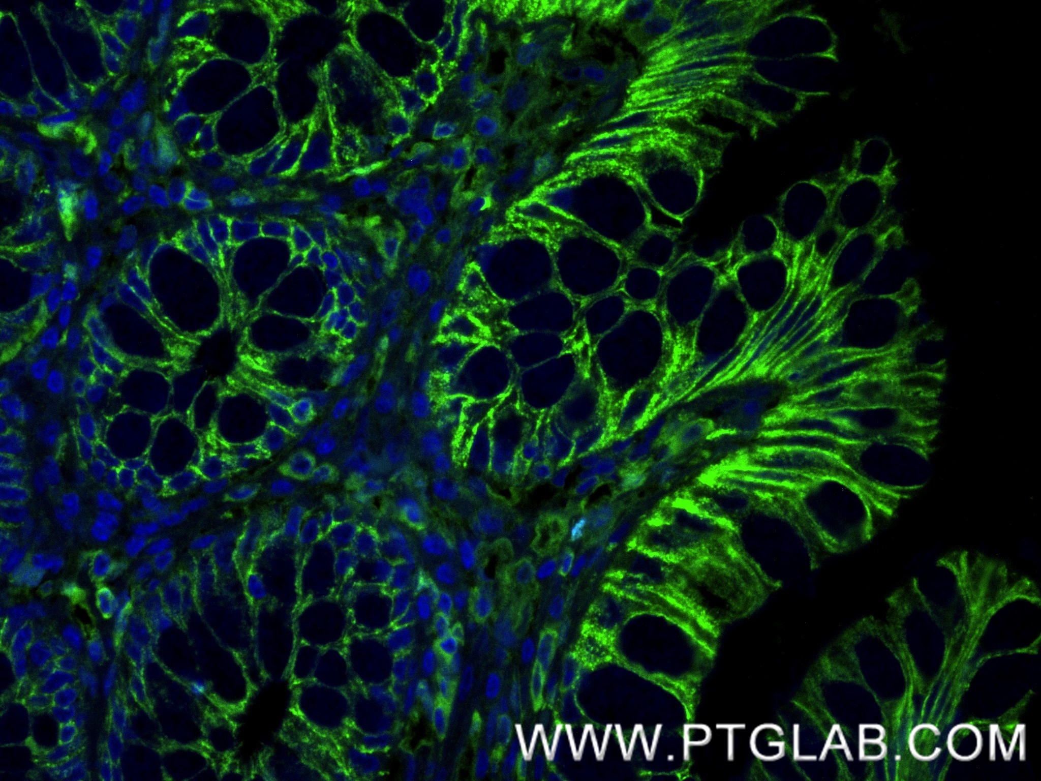 Immunofluorescence (IF) / fluorescent staining of human colon  tissue using E-cadherin Recombinant monoclonal antibody (80541-9-RR)