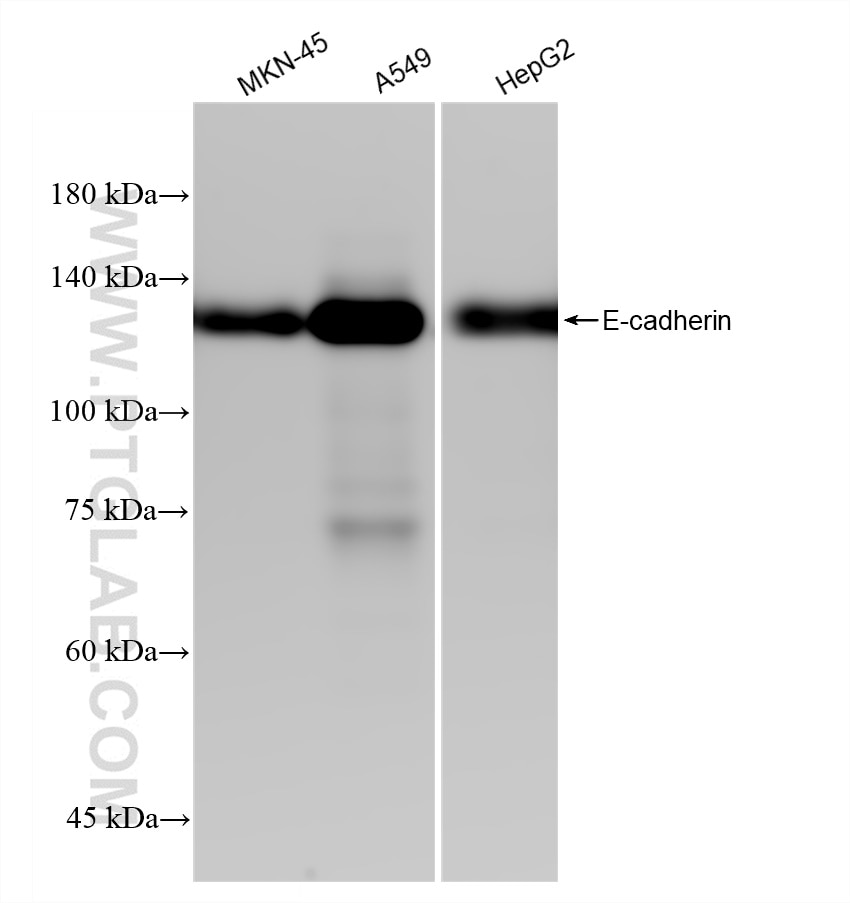 Western Blot (WB) analysis of various lysates using E-cadherin Recombinant antibody (80541-9-RR)