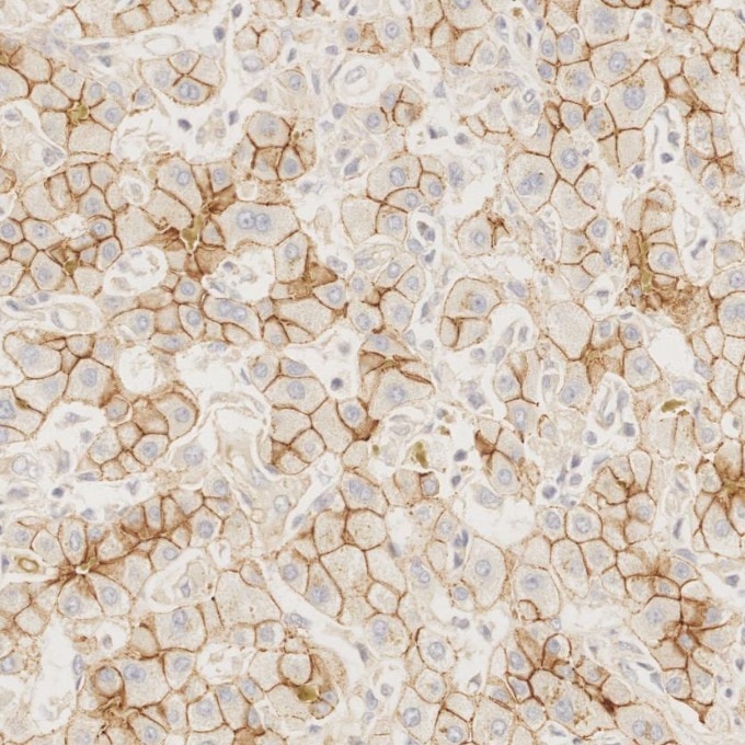 Immunohistochemistry (IHC) staining of human liver tissue using E-cadherin Recombinant monoclonal antibody (83991-4-RR)
