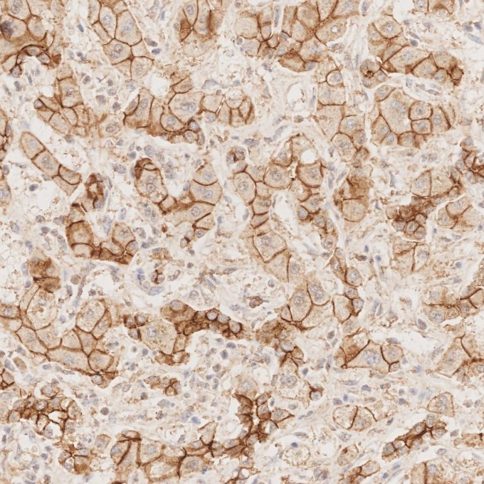 Immunohistochemistry (IHC) staining of human liver tissue using E-cadherin Recombinant monoclonal antibody (83991-4-RR)