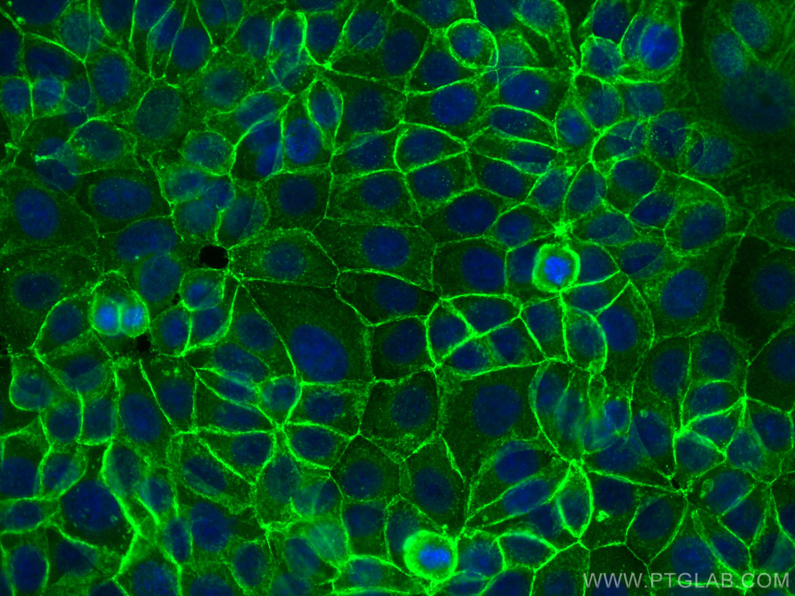 Immunofluorescence (IF) / fluorescent staining of MCF-7 cells using CoraLite® Plus 488-conjugated E-cadherin Polyclona (CL488-20874)