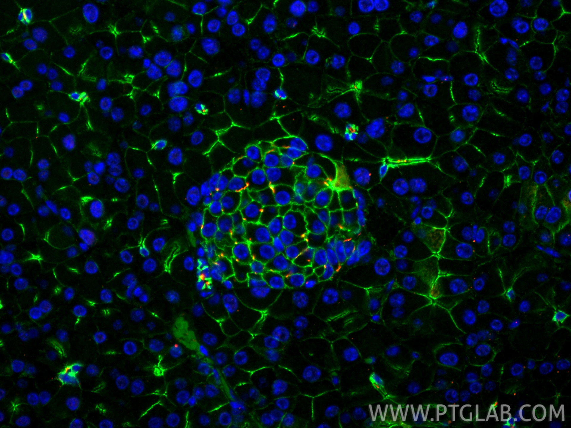 Immunofluorescent analysis of (4% PFA) fixed paraffin-embedded mouse pancreas tissue using CoraLite® Plus 488 E-cadherin antibody (CL488-20874) at dilution of 1:200, ARL13B antibody (17711-1-AP, red). Heat mediated antigen retrieval with Tris-EDTA buffer (pH 9.0). Immunofluorescence (IF) / fluorescent staining of mouse pancreas tissue using CoraLite® Plus 488-conjugated E-cadherin Polyclona (CL488-20874)