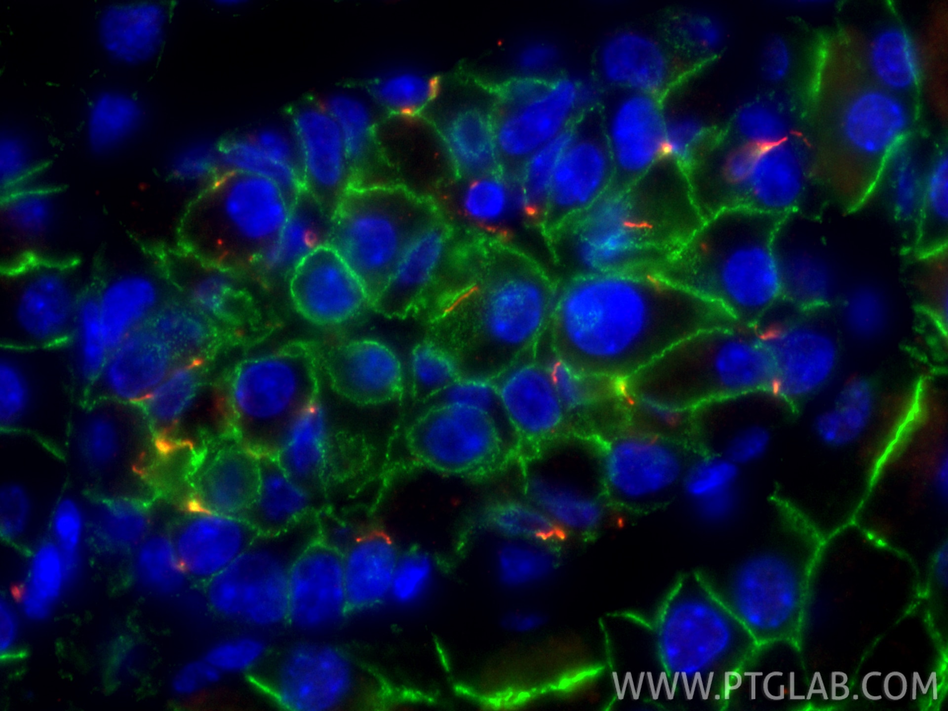 Immunofluorescent analysis of (4% PFA) fixed paraffin-embedded mouse pancreas tissue using CoraLite® Plus 488 E-cadherin antibody (CL488-20874) at dilution of 1:200, ARL13B antibody (17711-1-AP, red). Heat mediated antigen retrieval with Tris-EDTA buffer (pH 9.0). Immunofluorescence (IF) / fluorescent staining of mouse pancreas tissue using CoraLite® Plus 488-conjugated E-cadherin Polyclona (CL488-20874)