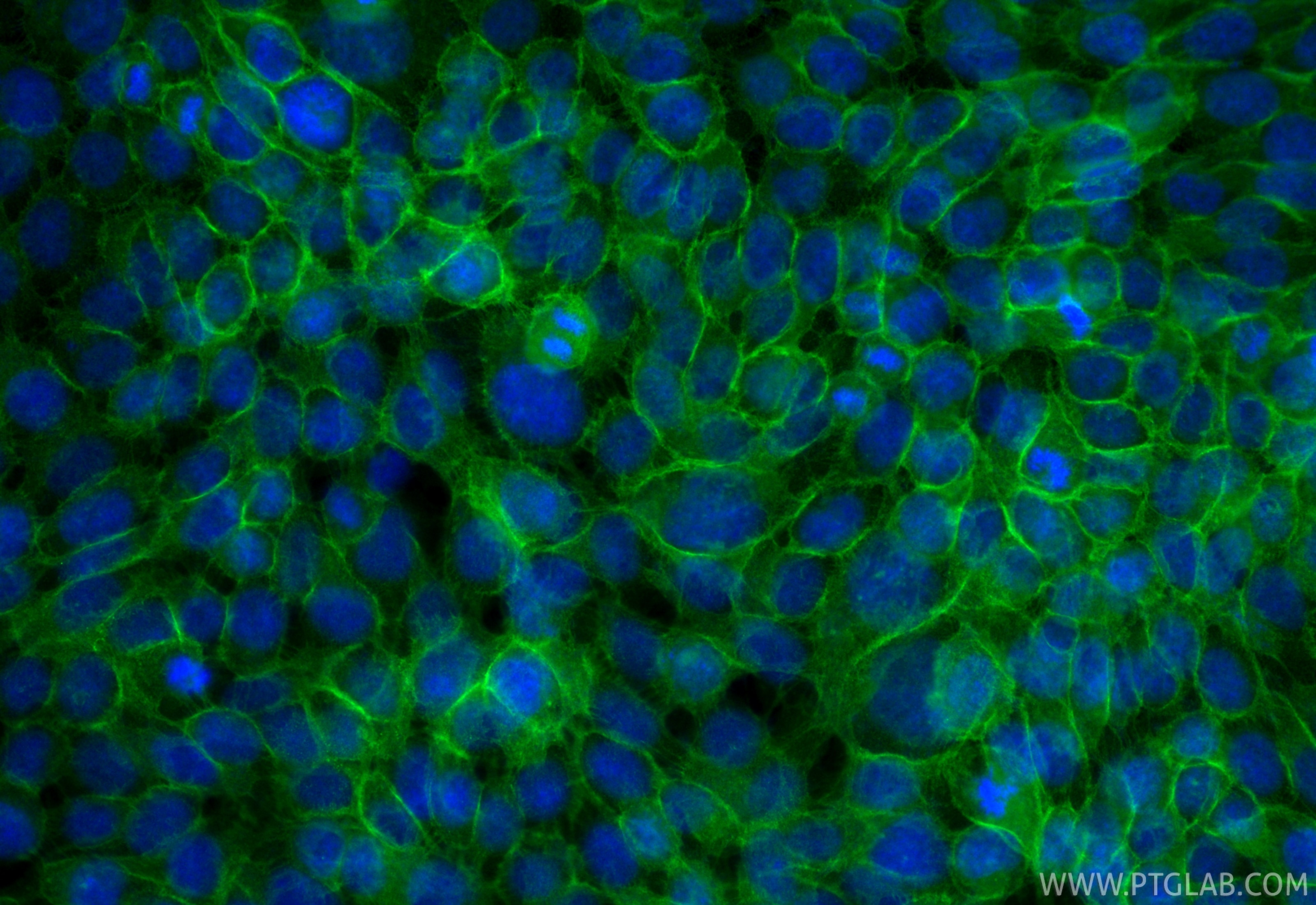 IF Staining of A431 using CL488-20874 Immunofluorescence (IF) / fluorescent staining of A431 cells using CoraLite® Plus 488-conjugated E-cadherin Polyclona (CL488-20874)