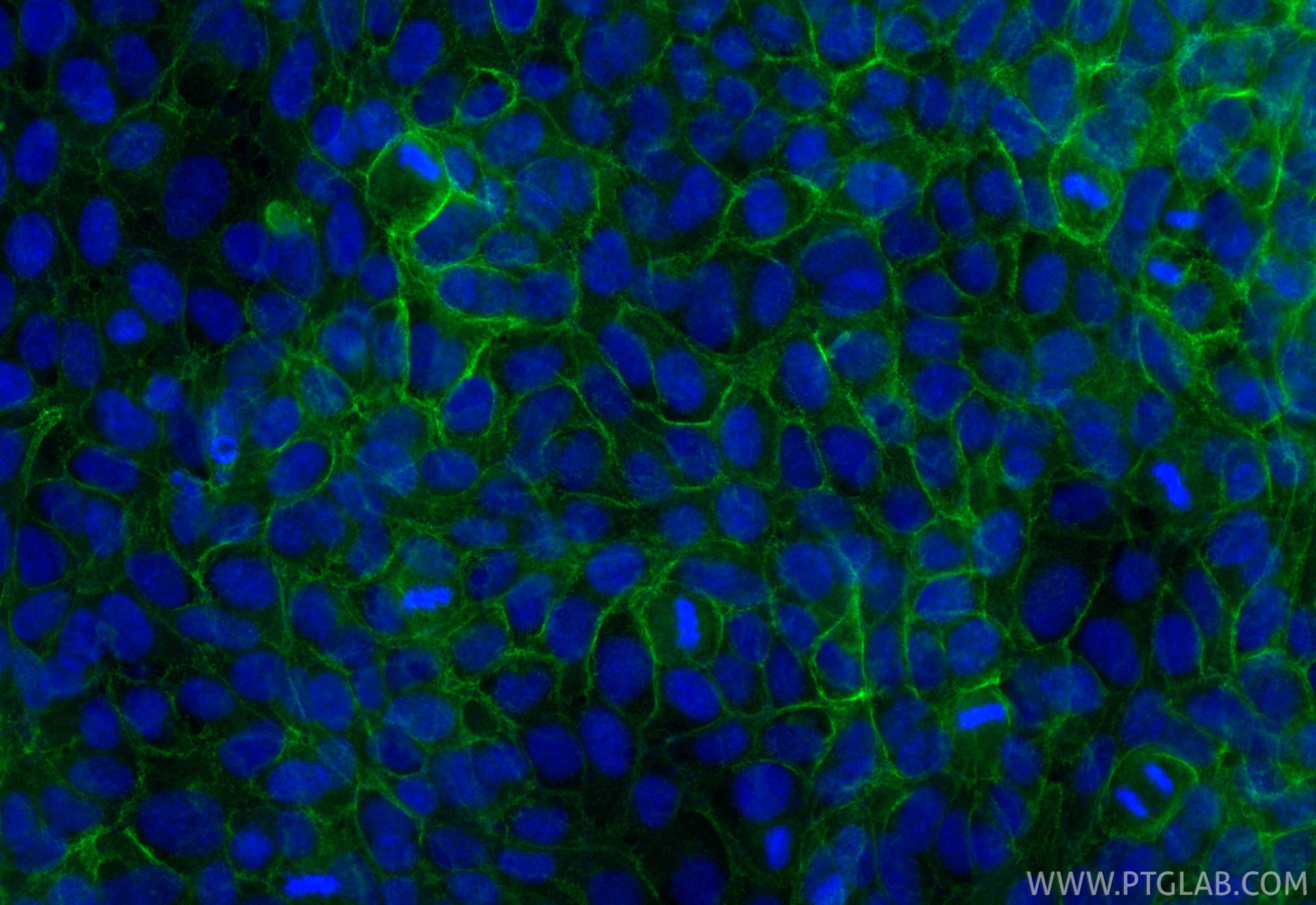 Immunofluorescent analysis of (-20°C Methanol) fixed A431 cells using CoraLite® Plus 488 E-cadherin antibody (CL488-84111-2, Clone: 241282A8 ) at dilution of 1:200. Immunofluorescence (IF) / fluorescent staining of A431 cells using CoraLite® Plus 488-conjugated E-cadherin Recombina (CL488-84111-2)