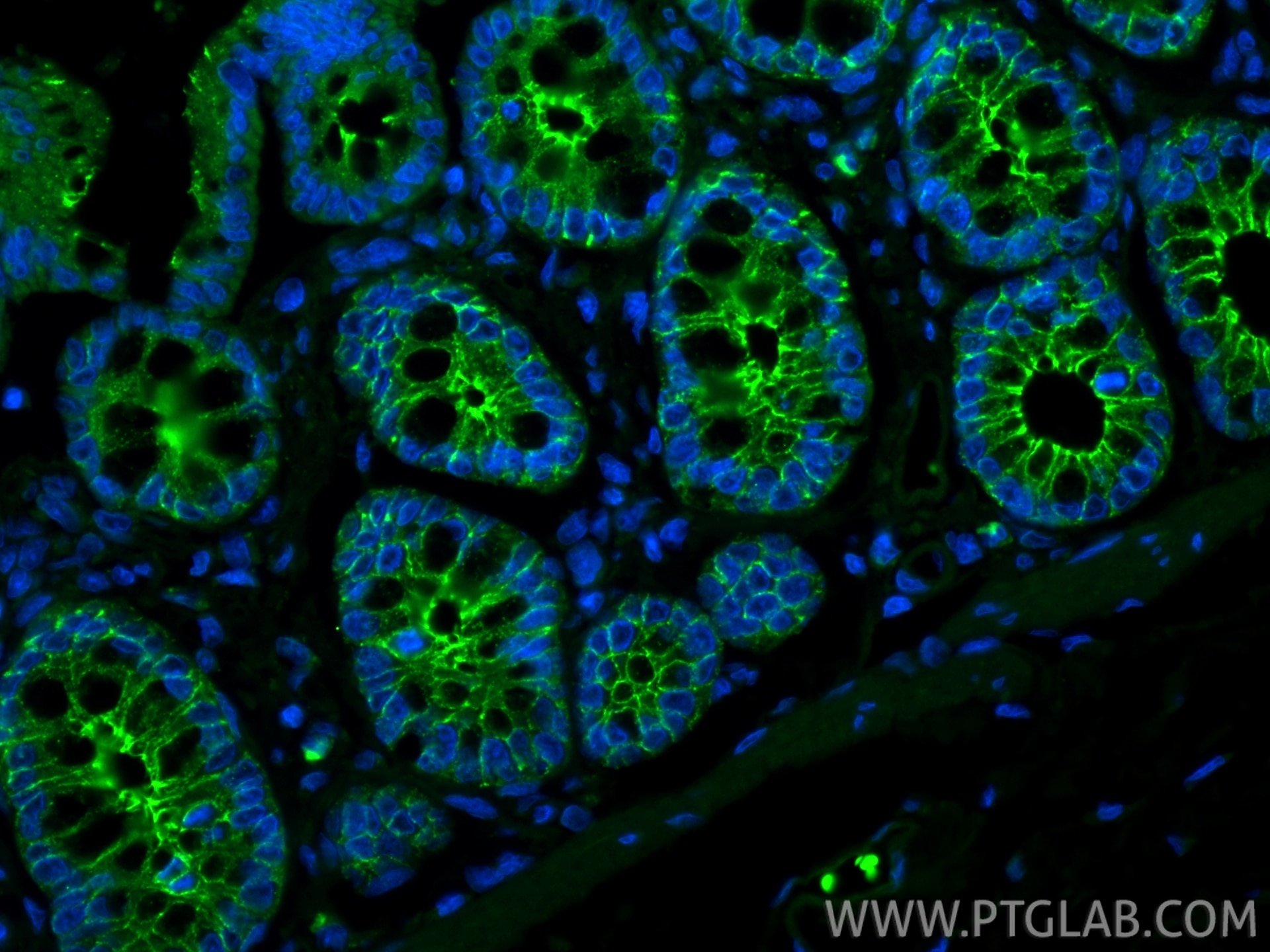 Immunofluorescent analysis of (4% PFA) fixed paraffin-embedded rat colon tissue using CoraLite® Plus 488 E-cadherin antibody (CL488-84646-3, Clone: 242018D3 ) at dilution of 1:200. Heat mediated antigen retrieval with Tris-EDTA buffer (pH 9.0). Immunofluorescence (IF) / fluorescent staining of rat colon tissue using CoraLite® Plus 488-conjugated E-cadherin Recombina (CL488-84646-3)