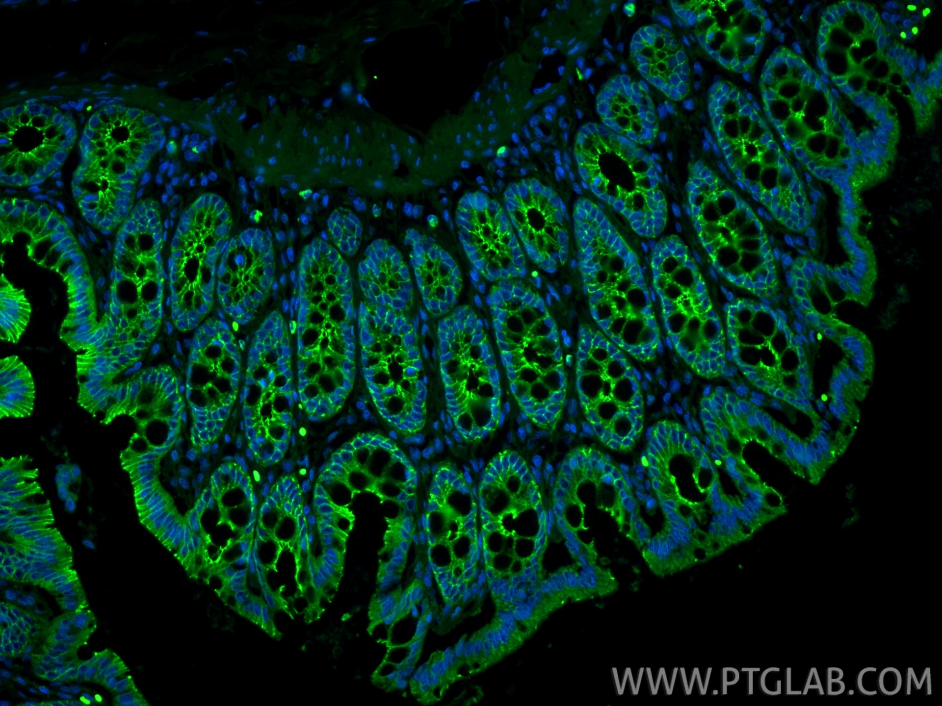 Immunofluorescent analysis of (4% PFA) fixed paraffin-embedded rat colon tissue using CoraLite® Plus 488 E-cadherin antibody (CL488-84646-3, Clone: 242018D3 ) at dilution of 1:200. Heat mediated antigen retrieval with Tris-EDTA buffer (pH 9.0). Immunofluorescence (IF) / fluorescent staining of rat colon tissue using CoraLite® Plus 488-conjugated E-cadherin Recombina (CL488-84646-3)
