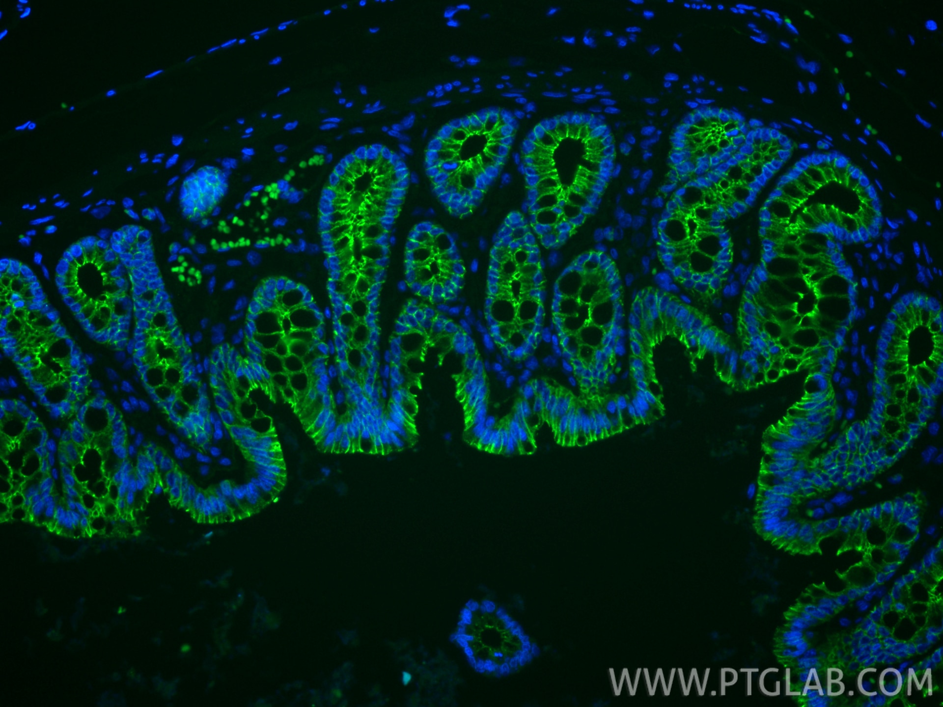 Immunofluorescent analysis of (4% PFA) fixed paraffin-embedded rat colon tissue using CoraLite® Plus 488 E-cadherin antibody (CL488-84646-4, Clone: 242018C10 ) at dilution of 1:200. Heat mediated antigen retrieval with Tris-EDTA buffer (pH 9.0). Immunofluorescence (IF) / fluorescent staining of rat colon tissue using CoraLite® Plus 488-conjugated E-cadherin Recombina (CL488-84646-4)