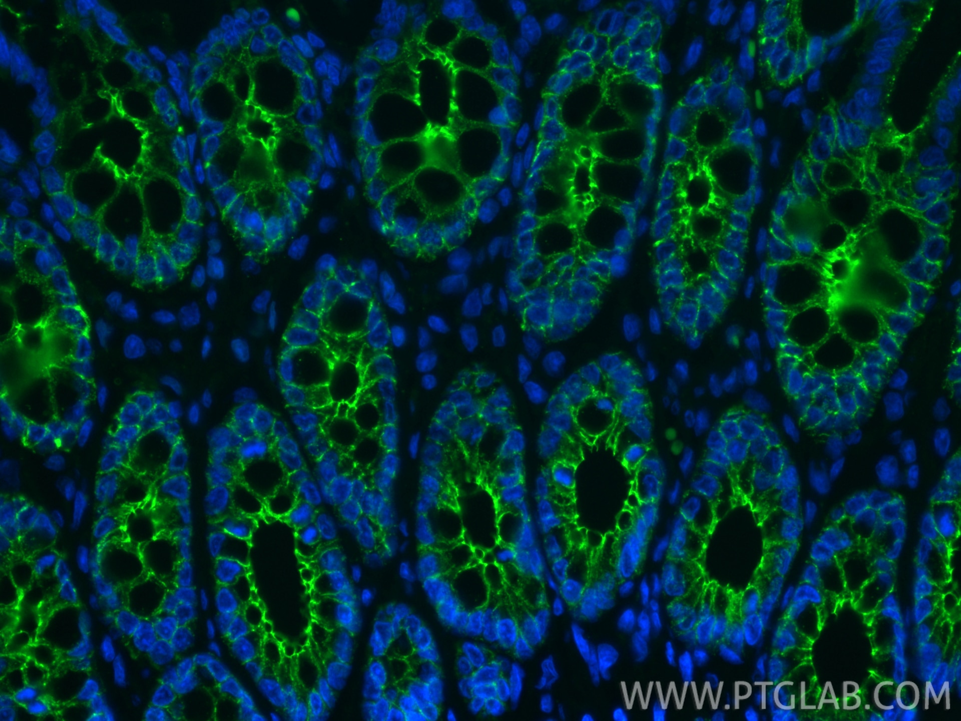 Immunofluorescent analysis of (4% PFA) fixed paraffin-embedded rat colon tissue using CoraLite® Plus 488 E-cadherin antibody (CL488-84646-4, Clone: 242018C10 ) at dilution of 1:200. Heat mediated antigen retrieval with Tris-EDTA buffer (pH 9.0). Immunofluorescence (IF) / fluorescent staining of rat colon tissue using CoraLite® Plus 488-conjugated E-cadherin Recombina (CL488-84646-4)
