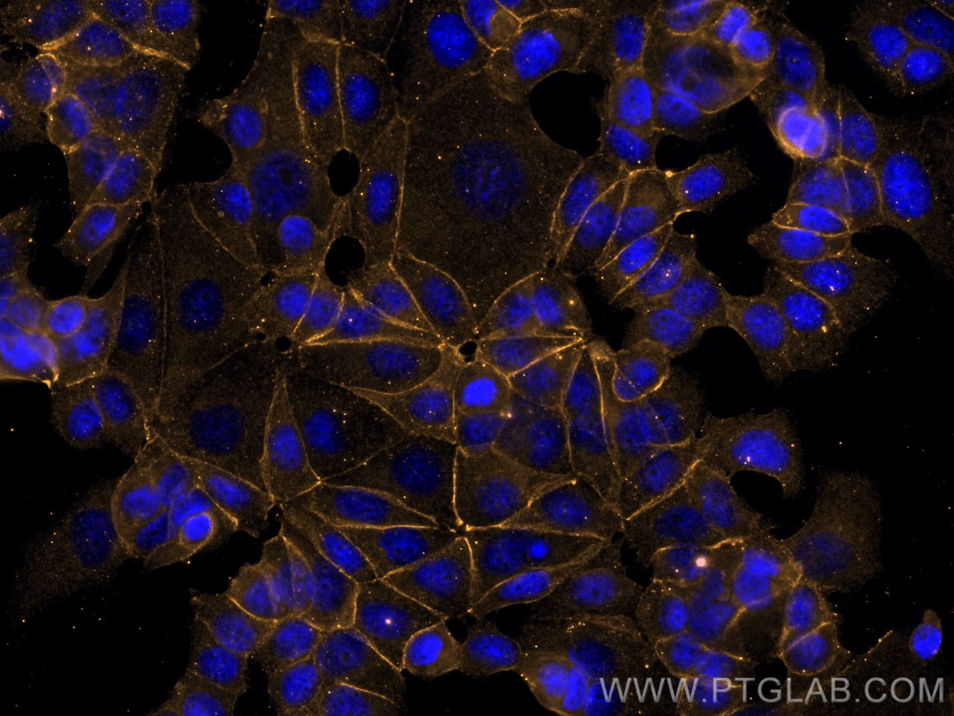 Immunofluorescence (IF) / fluorescent staining of MCF-7 cells using CoraLite®555-conjugated E-cadherin Monoclonal anti (CL555-60335)