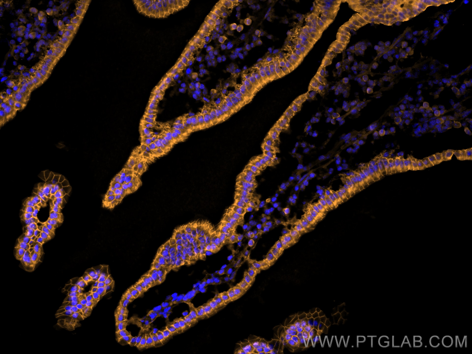 Immunofluorescence (IF) / fluorescent staining of mouse small intestine tissue using CoraLite®555-conjugated E-cadherin Monoclonal anti (CL555-60335)