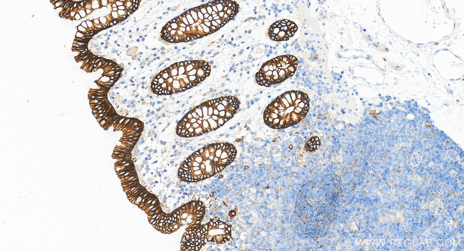 IHC staining of human colon using RMX00039 Immunohistochemistry (IHC) staining of human colon tissue using Multi-rAb® E-cadherin Multi-Recombinant antibody (RMX00039)