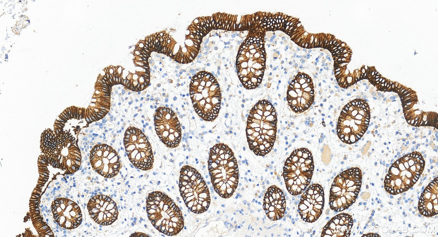 IHC staining of human colon using RMX00039 Immunohistochemistry (IHC) staining of human colon tissue using Multi-rAb® E-cadherin Multi-Recombinant antibody (RMX00039)
