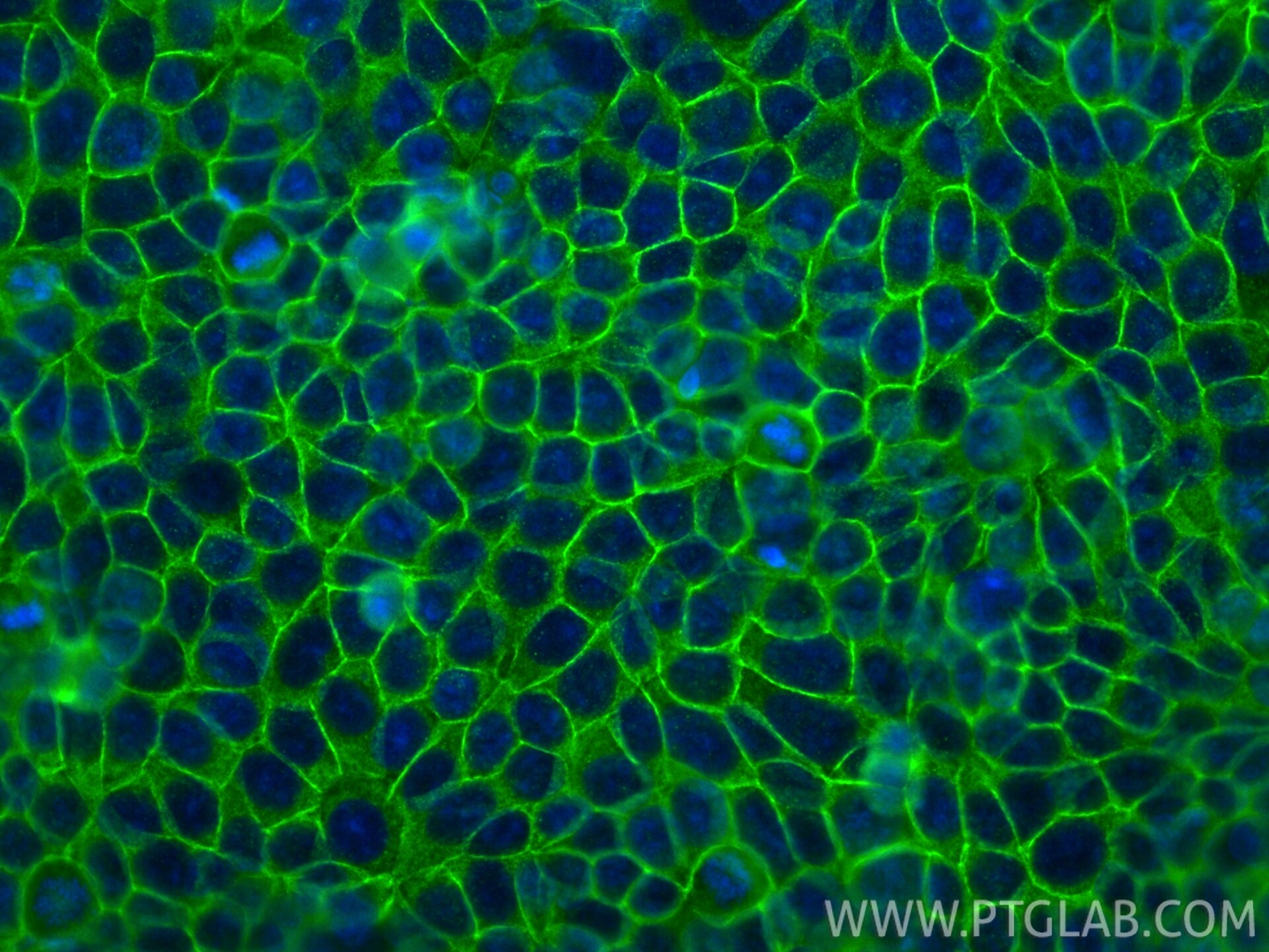 IF Staining of MCF-7 using RMX00039 Immunofluorescence (IF) / fluorescent staining of MCF-7 cells using Multi-rAb® E-cadherin Multi-Recombinant antibody (RMX00039)