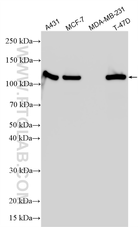 WB analysis using RMX00039 Western Blot (WB) analysis of various lysates using Multi-rAb® E-cadherin Multi-Recombinant antibody (RMX00039)