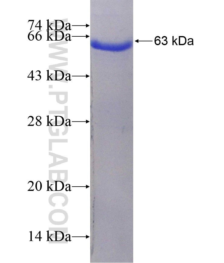 E-cadherin fusion protein Ag14973 SDS-PAGE