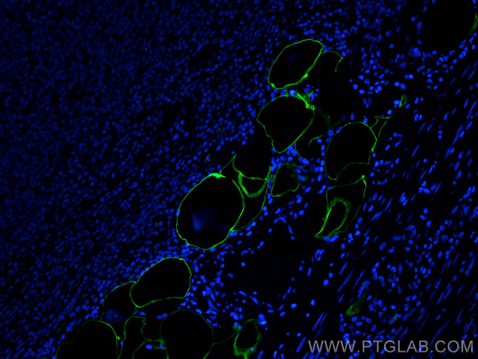 Immunofluorescence (IF) / fluorescent staining of human appendicitis tissue using E-selectin / CD62E Polyclonal antibody (30205-1-AP)