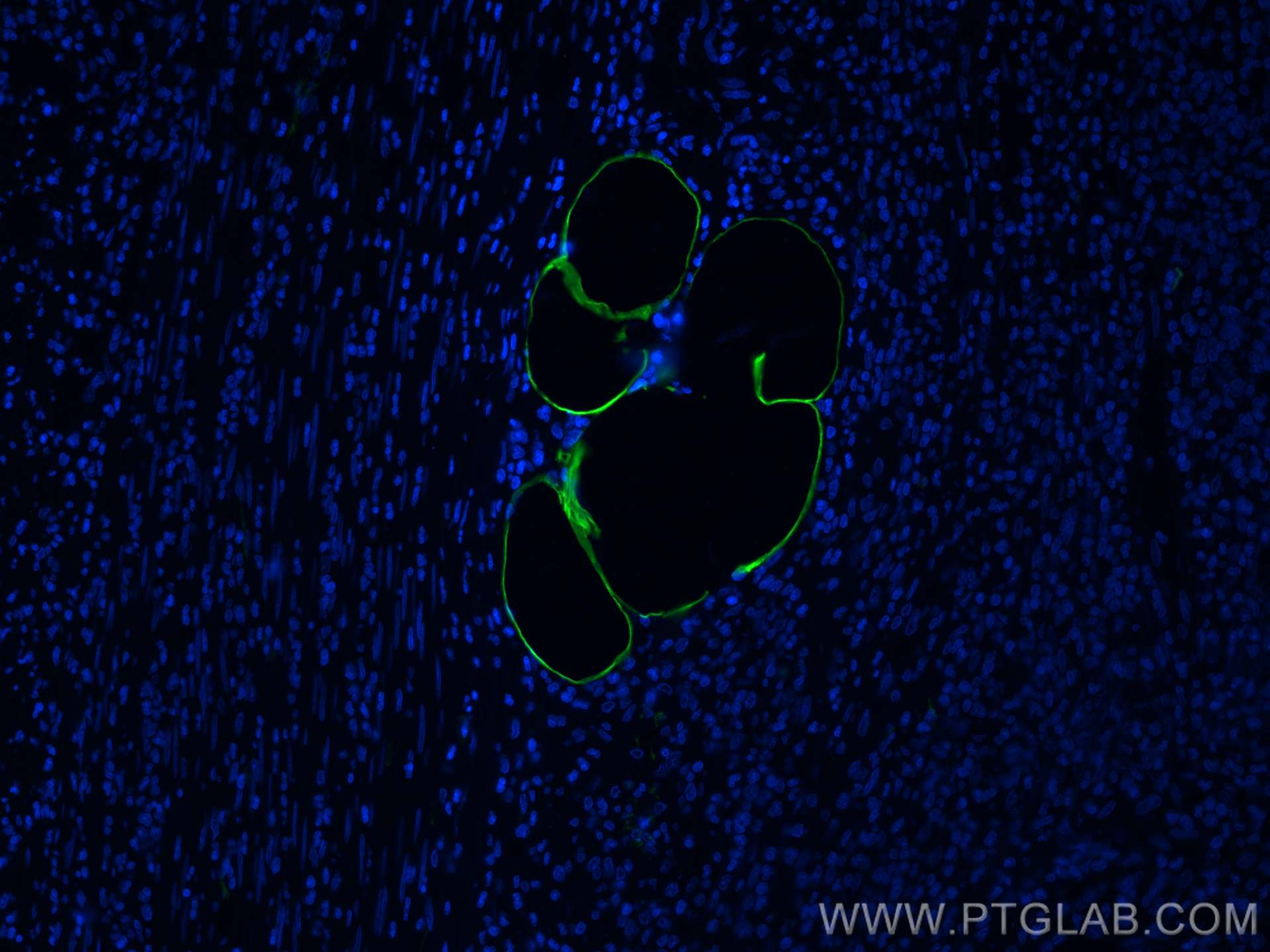 Immunofluorescence (IF) / fluorescent staining of human appendicitis tissue using E-selectin / CD62E Polyclonal antibody (30205-1-AP)