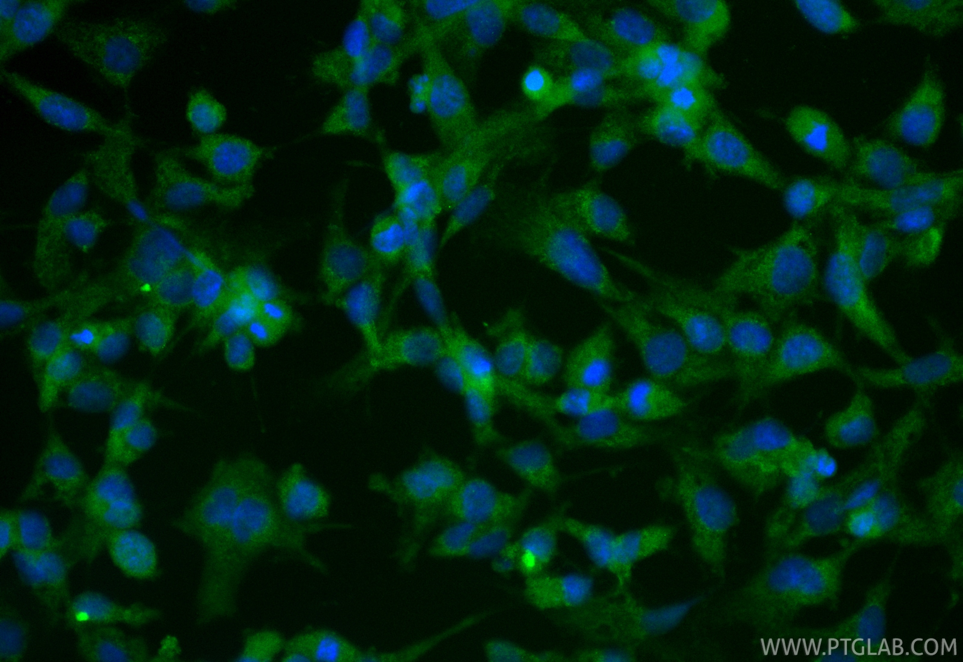Immunofluorescence (IF) / fluorescent staining of HUVEC cells using CoraLite® Plus 488-conjugated E-selectin / CD62E P (CL488-30205)
