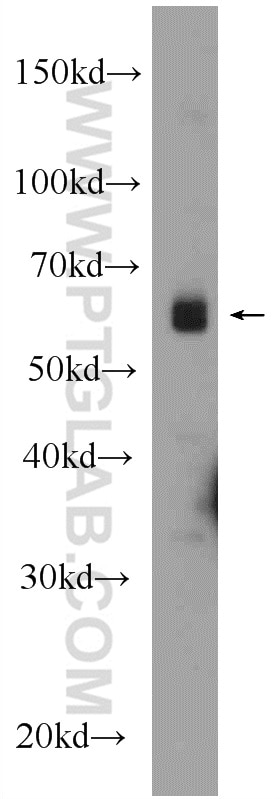 Western Blot (WB) analysis of mouse brain tissue using E2F1 Polyclonal antibody (12171-1-AP)