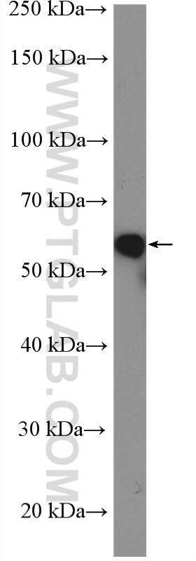 Western Blot (WB) analysis of HeLa cells using E2F1 Polyclonal antibody (12171-1-AP)