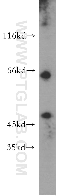 E2F1