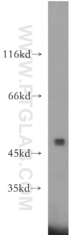 Western Blot (WB) analysis of A431 cells using E2F1 Polyclonal antibody (12171-1-AP)