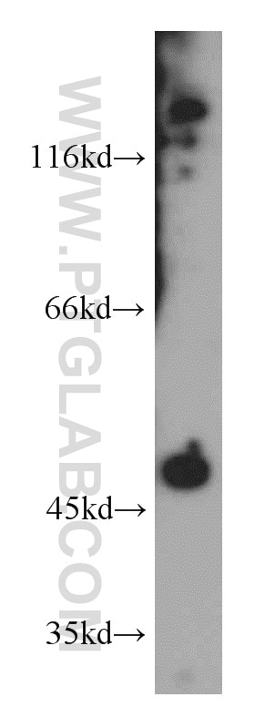 Western Blot (WB) analysis of A431 cells using E2F1 Polyclonal antibody (12171-1-AP)