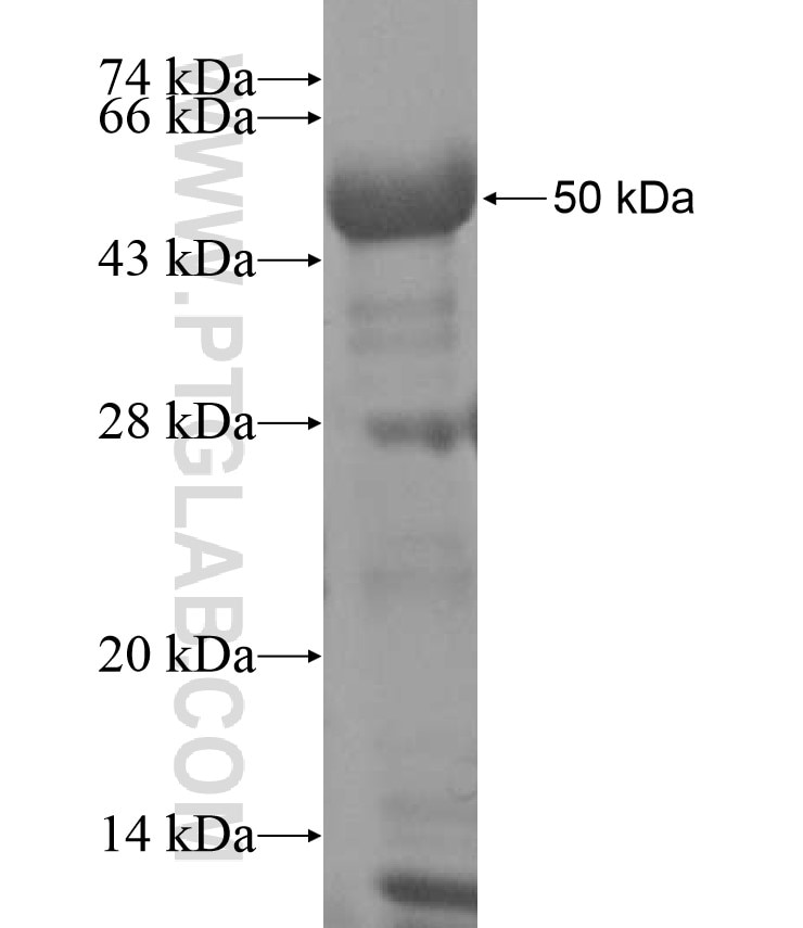 E2F1 fusion protein Ag17363 SDS-PAGE