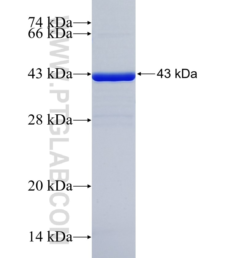 E2F2 fusion protein Ag35281 SDS-PAGE E2F2 fusion protein Ag35281 SDS-PAGE