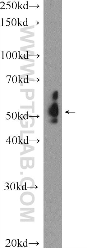 Western Blot (WB) analysis of mouse liver tissue using E2F3 Polyclonal antibody (12334-1-AP)