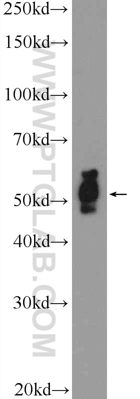 Western Blot (WB) analysis of Y79 cells using E2F3 Polyclonal antibody (12334-1-AP)