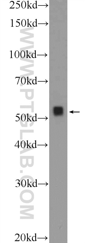 E2F3 Polyclonal antibody