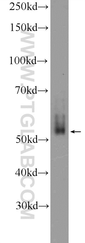 Western Blot (WB) analysis of HEK-293 cells using E2F3 Polyclonal antibody (12334-1-AP)