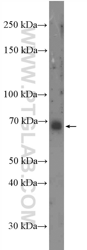 Western Blot (WB) analysis of SKOV-3 cells using E2F3 Polyclonal antibody (27615-1-AP)