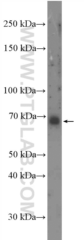 WB analysis of SKOV-3 using 27615-1-AP