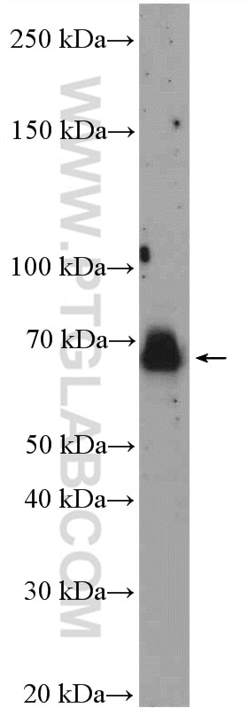 Western Blot (WB) analysis of SGC-7901 cells using E2F3 Polyclonal antibody (27615-1-AP)