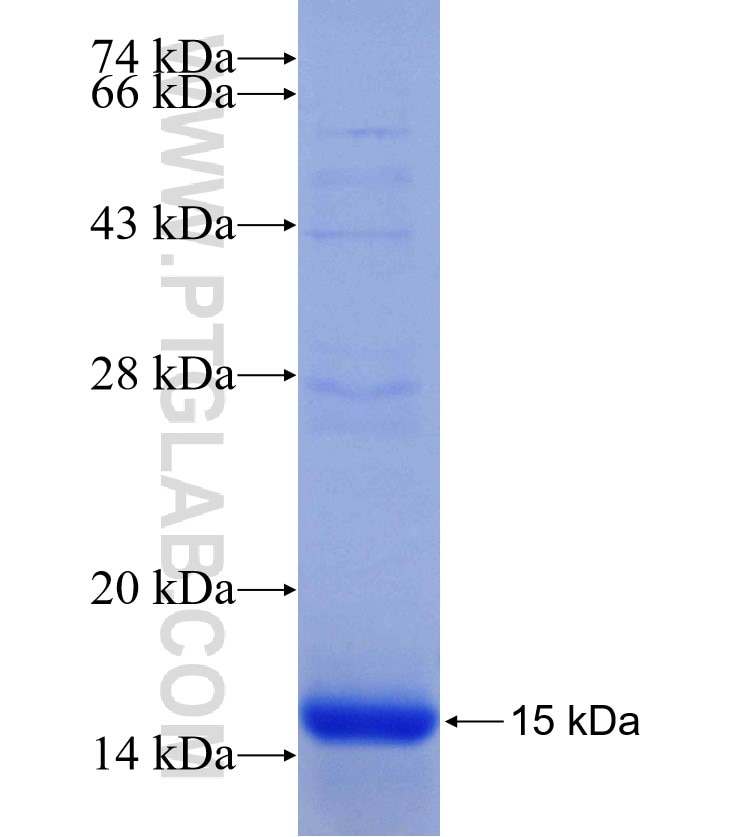 E2F3 fusion protein Ag14560 SDS-PAGE