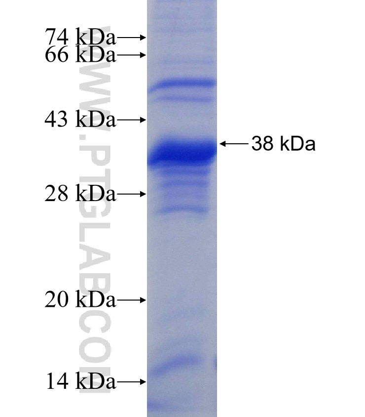 E2F3 fusion protein Ag3039 SDS-PAGE