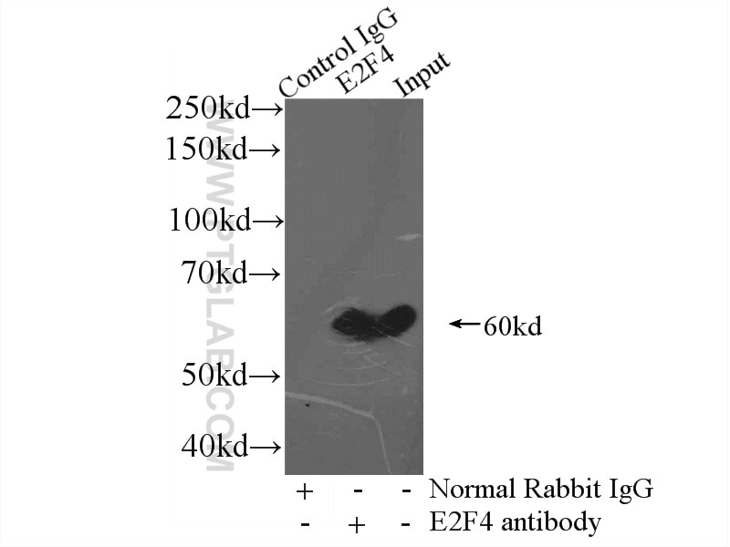 Immunoprecipitation (IP) experiment of mouse brain tissue using E2F4 Polyclonal antibody (10923-1-AP)