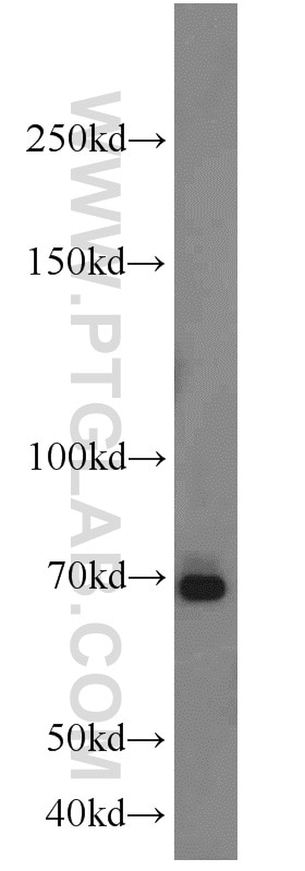 Western Blot (WB) analysis of A431 cells using E2F4 Polyclonal antibody (10923-1-AP)