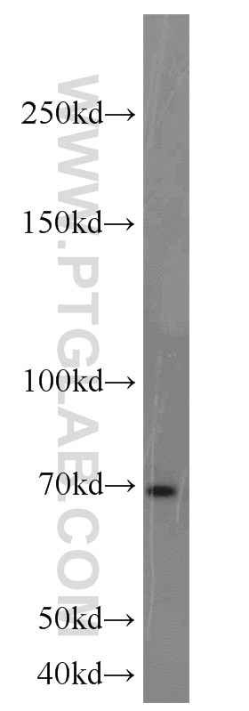 Western Blot (WB) analysis of Jurkat cells using E2F4 Polyclonal antibody (10923-1-AP)