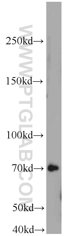 WB analysis of HL-60 using 10923-1-AP