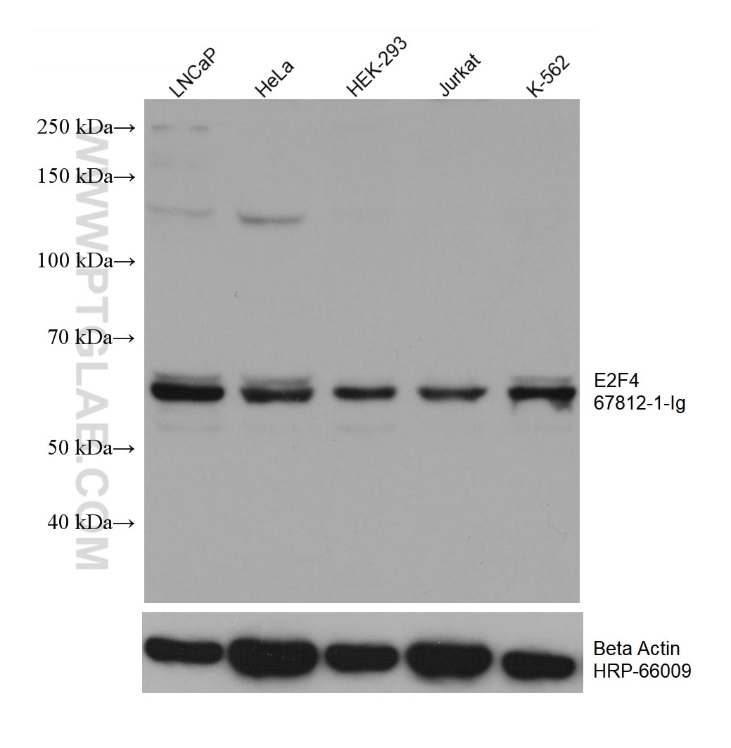 Western Blot (WB) analysis of various lysates using E2F4 Monoclonal antibody (67812-1-Ig)