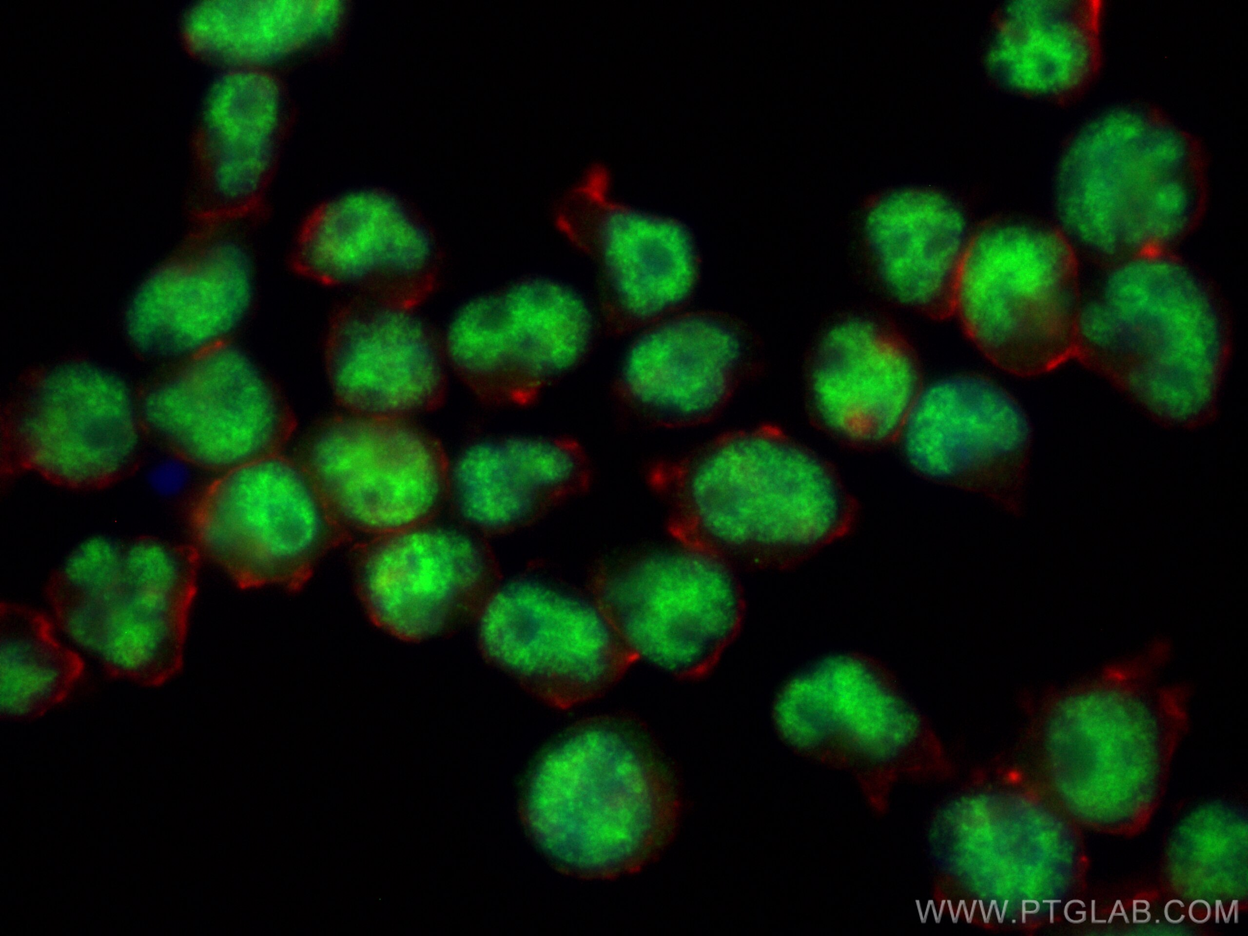 Immunofluorescence (IF) / fluorescent staining of Jurkat cells using E2F6 Polyclonal antibody (31464-1-AP)