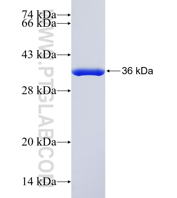 E2F6 fusion protein Ag35112 SDS-PAGE
